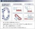 歯の磨き方.jpg