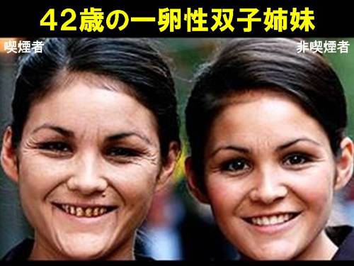 ４２歳の一卵性双子姉妹.jpg