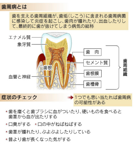歯周病とは.JPG