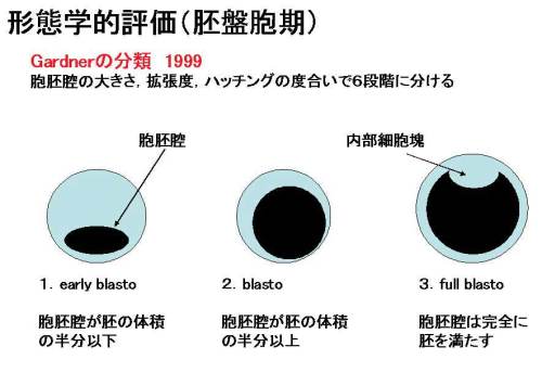 ガードナーの胚盤胞.jpg