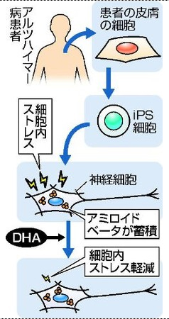 アルツハイマーとＤＨＡ.jpg