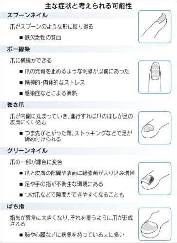 爪で分かる体のｓｏｓ 茶色の場合は腎臓に異常も 健康増進 病気予防 抗加齢 アンチエイジング 長寿 統合医療 ダイエット 競技力 豊かさ 幸せ探求 楽天ブログ