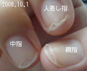 2008.10乾燥爪