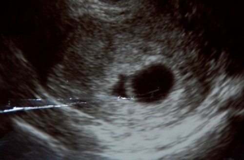 あかちん2枚目3枚目　小さなクリスマスケーキ　楽天から 026.jpg