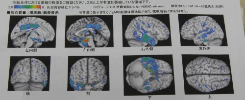 診断イメージ４