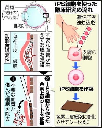 iPS細胞１.jpg