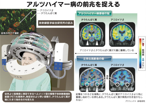 認知症の前兆.jpg