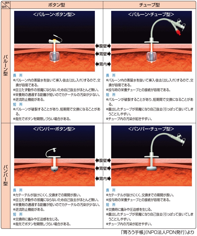 PEGの種類.jpg