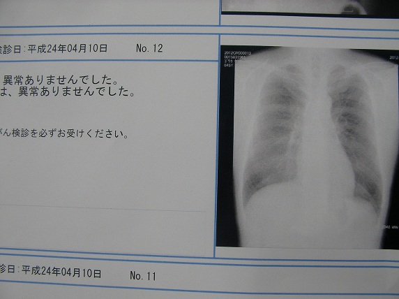 checkup lung cancer.jpg