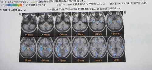 診断イメージ２